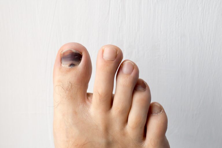 Foto iStock